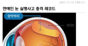 Read more about the article 심한 망막박리, 연예인 실명 위기 – 군 면제의 비밀