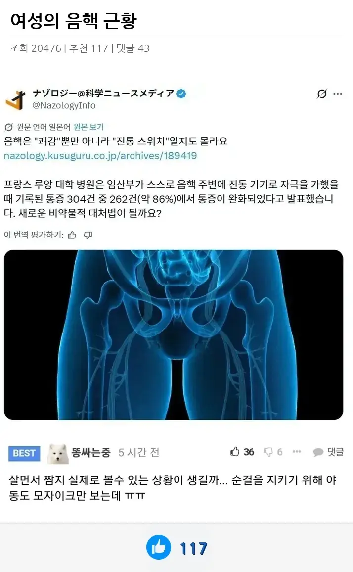 A2936390_02.webp